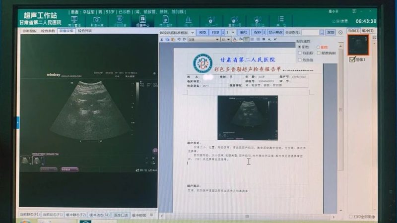 运动基因检测：揭秘其优缺点**